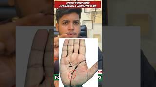 Operationpregnancy & Accident sign in palm हस्थरेखा में दुर्घटना के योग ।#palmistry #viral #reels