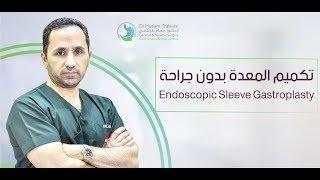 تكميم المعدة بدون جراحة   Endoscopic Sleeve Gastroplasty