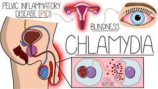 Understanding Chlamydia Chlamydia Trachomatis Explained Clearly