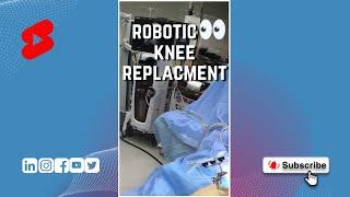 Robotic Knee Surgery #shorts