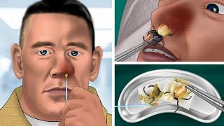 ASMR help John Cena remove a bug and a big snot from his nostril  WOW Brain Satisfyingvideo