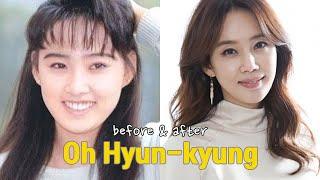 Oh Hyun-kyung before and after