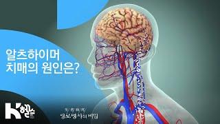 알츠하이머 치매의 원인 - 20181212_674회 방송 누구도 예외일 수 없다 치매