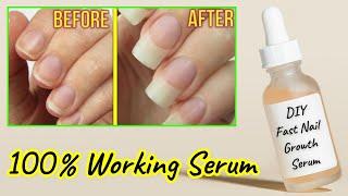 How to make nail growth serum at home  how to grow nails  nails grow faster  Sajal Malik