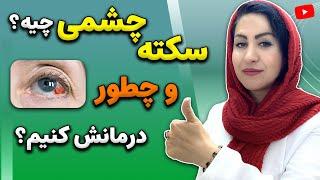 سکته چشمی چیست؟  علل، روش های پیشگیری و درمان سکته چشم با این راهکارهای طبیعی