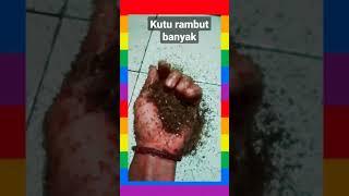 kutu rambut terbanyak didunia