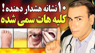 10 نشانه هشدار دهنده که کلیه هات سمی شدند باید بدانید  Signs That Your Kidneys Have Become Toxic