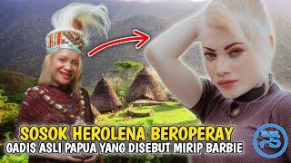 Herolena Beroperay Gadis Papua yang Viral karna terlahir sebagai sosok berbeda dari yang lain