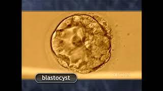 The Biology of Prenatal Development - Morula and Blastocyst