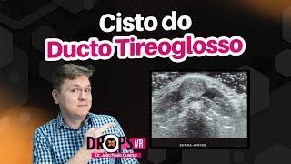 APRENDA O QUE É CISTO DO DUCTO TIREOGLOSSO I VOCÊ RADIOLOGISTA