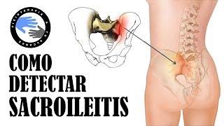 ¿Dolor lumbar? 3 test para saber si tu sacroiliaca te esta causando una sacroileitis