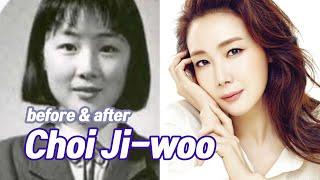 Choi Ji-woo before and after