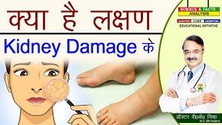 क्या है लक्षण Kidney Damage के TOXIC KIDNEY COMMON SIGNS THAT  YOUR KIDNEY IS NOT WORKING PROPERLY