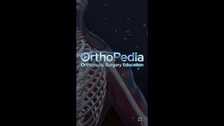 OrthoPedia - Dr. Denard Tips and Pearls Rotator Cuff Tears