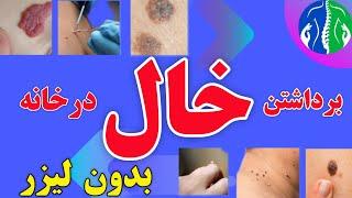 از بین بردن خال خال های صورت را چگونه از بین ببریم  برداشتن خال به روش خانگی