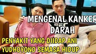 Mengenal Kanker Darah Penyakit yang Diidap Ani Yudhoyono Semasa Hidup