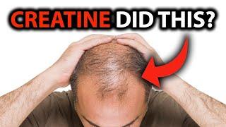 Does Creatine Cause Hair Loss Baldness?