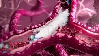 Medical Devices Animation Highlight Reel  Random42