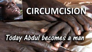 Circumcision A Painful Rite of Passage