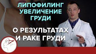 Липофилинг при увеличении груди. О результате и раке молочной железы. 18+