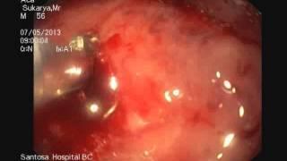 Endoscopy _ 2