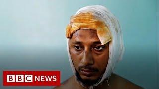 Delhi riots No-one who saw the photo thought I would survive - BBC News