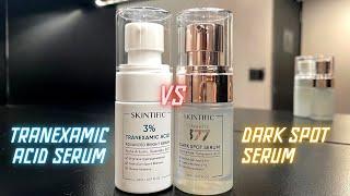 Battle SKINTIFIC TRANEXAMIC ACID VS DARKSPOT SERUM Bagusan Mana?