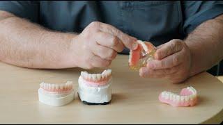 Dental Implants Brisbane - How Dental Implants Work