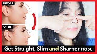 Get rid of hook nose & nose hump reduction naturally  Get Straight Slim & Sharper nose  Exercises