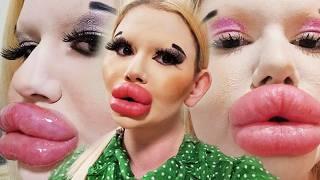 The BIGGEST Fake Lips Youve Ever Seen