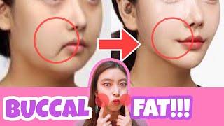 Buccal Fat Removal Exercise & Massage  Reduce Cheek Fat Chubby Cheeks No Surgery