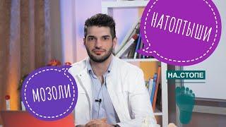 МОЗОЛЬ И НАТОПТЫШ как лечить #натоптыши #мозоли #плоскостопие