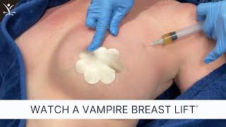 Non-Surgical Breast Lift for Better Cleavage and Natural Lift