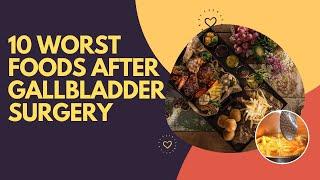 10 Worst Foods After Gallbladder Surgery