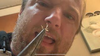 Pulling Nose Hairs with Needle Nose Pliers