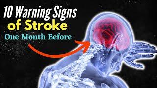 10 Warning Signs of Stroke One Month Before - Unbelievable Signs... Revealed