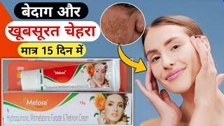 Melosa Cream Review  गोरा होने वाला क्रीम  Gora Hone Wala Cream