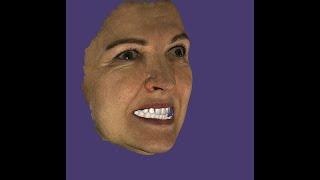 FaceScanСкан лица в стоматологическом планировании. Digital dental plan To make projectExocad