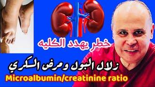 لن تصدق ..علامات تدهور وظايف الكلي زلال البول وتورم القدمين ومرض السكري MICROALBUMINURIA