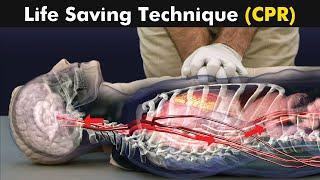 How cardiopulmonary resuscitation CPR is performed? UrduHindi