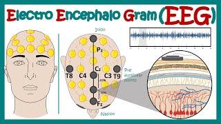 Electroencephalography EEG  How EEG test works?  What conditions can an EEG diagnose?  Animated