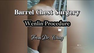 Barrel Chest Surgery—Wenlin Procedure