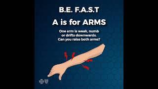 Stroke Symptoms & Warning Signs B.E. F.A.S.T.  #shorts