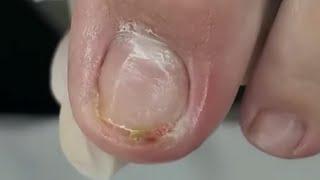 UNHA ENCRAVADA NA PONTA agora com o final #satisfying #nails