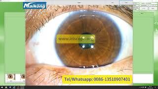 How to use install and uninstall maikong iridology software Malaysian 2024