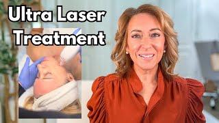 Laser Treatment for Sun Spots  & recommended at home skincare devices. #antiaging #skincaretreatment