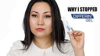 WHY I STOPPED USING DIFFERIN GEL  ADAPALENE GEL 0.1% ACNE TREATMENT  Zulayla