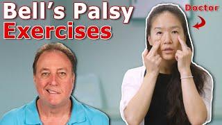 Easy Exercises For Bells Palsy Face Facial Paralysis  Unable to Smile  Physical Therapy