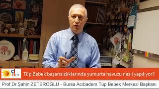 Tüp bebek tedavisinde yumurta havuzu nasıl yapılıyor? Prof.Dr.Şahin ZETEROĞLU