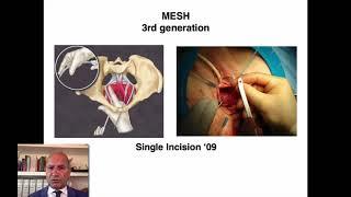 Wich Mesh for wich patient?